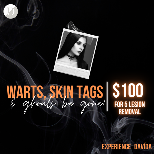 October Special - Warts, Skin Tags, and Ghouls be Gone!