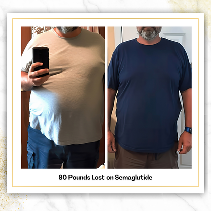 Semaglutide (Starter Pack)