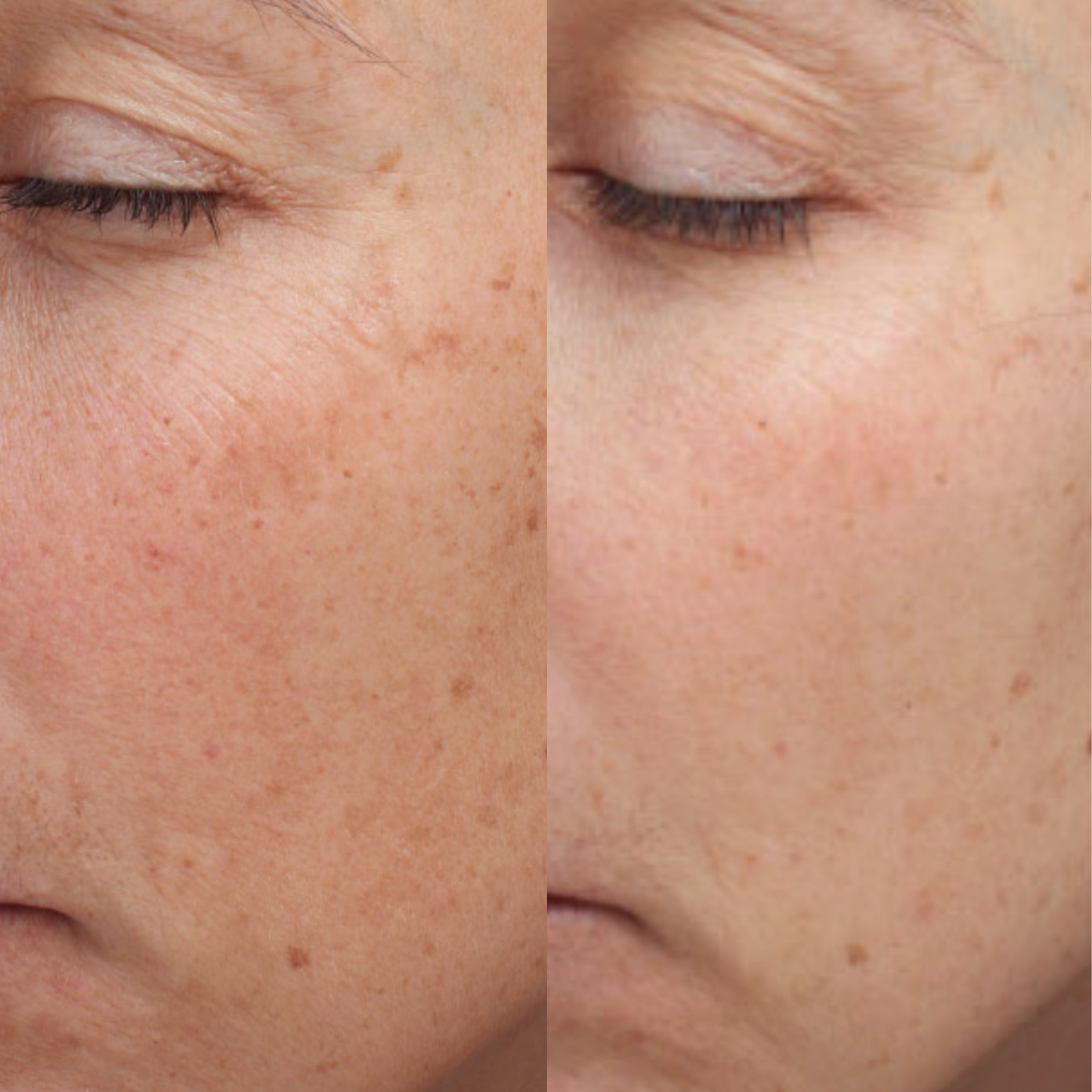 Epionce Intensive Nourishing Cream
