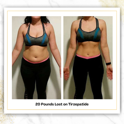 Tirzepatide (3-Month)
