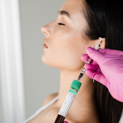 PRF Treatment in San Antonio | Natural Under-Eye | DaVida