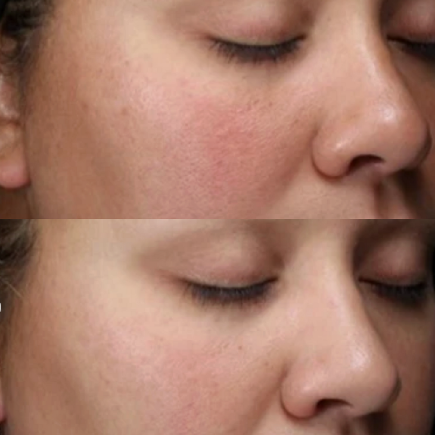 Alastin HA Immerse Hyaluronic Acid Serum