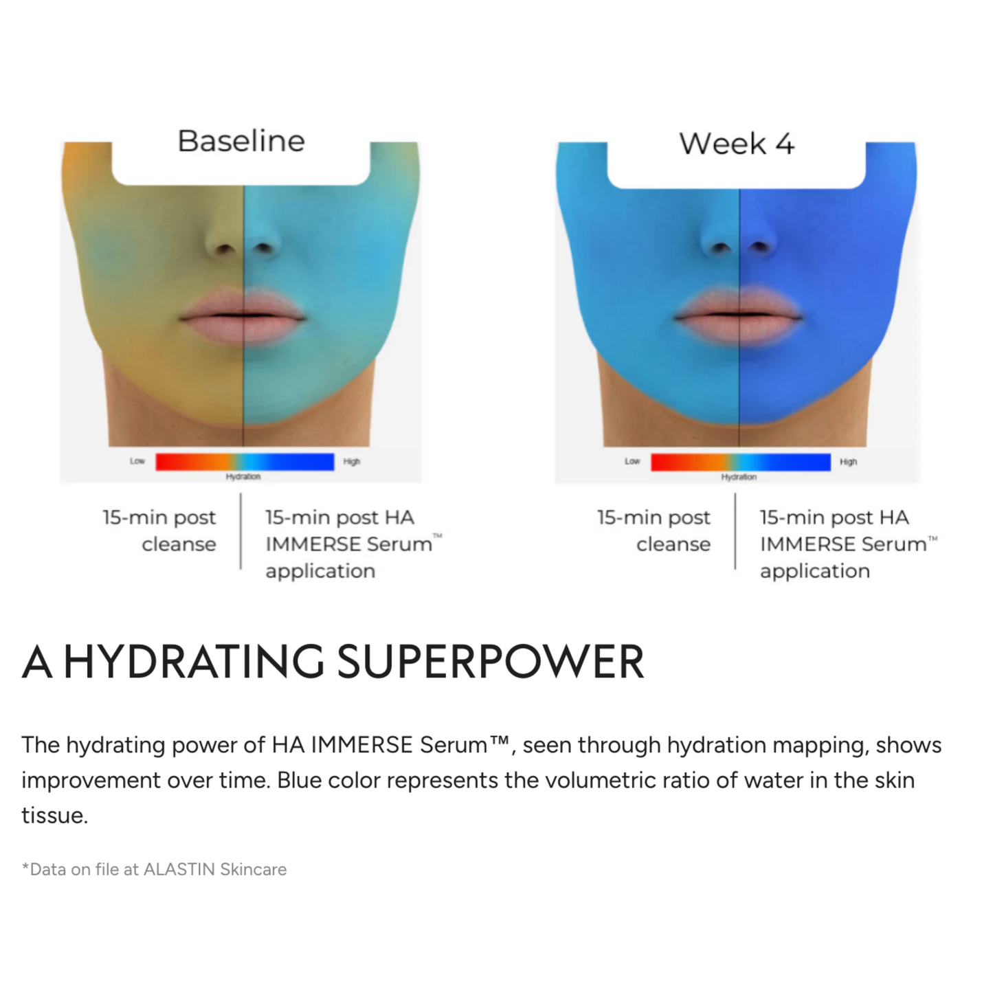 Alastin HA Immerse Hyaluronic Acid Serum
