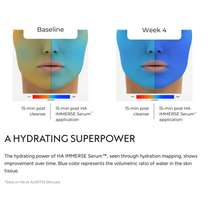 Alastin HA Immerse Hyaluronic Acid Serum
